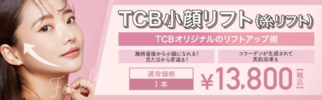 TCB東京中央美容外科の糸リフト