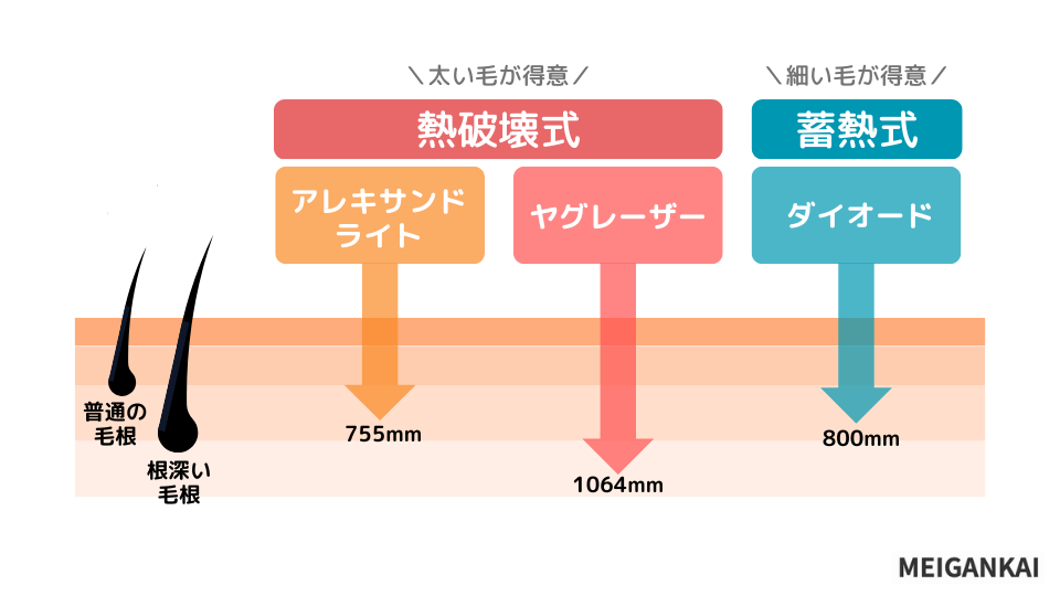 波長が違う2種類の脱毛機からクリニックを選ぼう