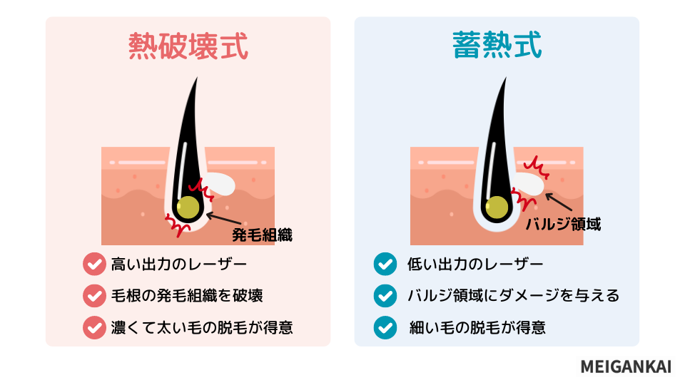 照射方法は熱破壊方式と蓄熱式の2つ